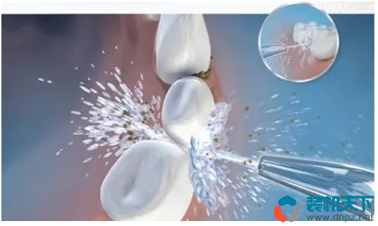 沖牙器有用嗎？沖牙器選購及使用技巧